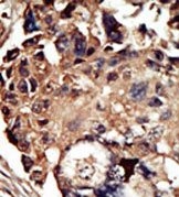 AP15037PU-N - PACSIN1