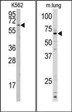 AP14897PU-N - CYP1A1