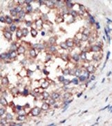AP14936PU-N - PIK3CG