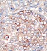 AP14946PU-N - PIK3R4