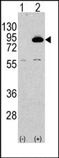AP14949PU-N - PIK3R2