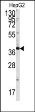 AP14959PU-N - Endophilin-B1