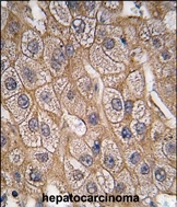 AP14959PU-N - Endophilin-B1