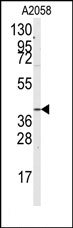 AP14960PU-N - G protein subunit alpha 12 / GNA12