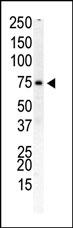 AP14963PU-N - PIP5K1B