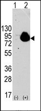 AP14824PU-N - RPS6KA1