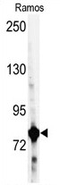 AP14837PU-N - Glycyl-tRNA synthetase