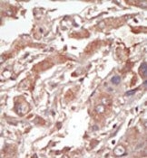 AP14848PU-N - STK10 / LOK