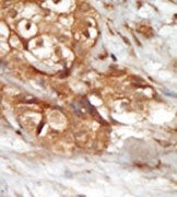 AP14868PU-N - MAP3K14