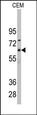 AP14743PU-N - CYP1B1