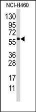 AP14749PU-N - CYP4F12