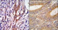AP14756PU-N - Aurora kinase A