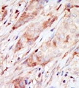 AP14758PU-N - Glucokinase / Hexokinase-4