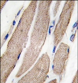 AP14768PU-N - MAP2K5