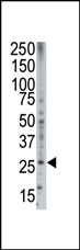 AP11303PU-N - BOK / BCL2L9