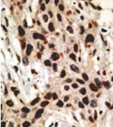 AP11305PU-N - MCL1