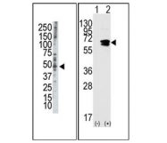 AP11314PU-N - RAD9A