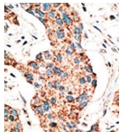 AP11314PU-N - RAD9A