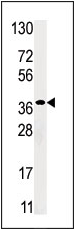 AP13842PU-N - Ribokinase / RBKS