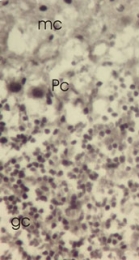 AP11335PU-N - TXNL1