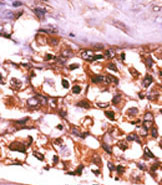 AP13842PU-N - Ribokinase / RBKS