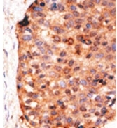 AP11343PU-N - APOBEC3G