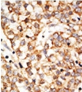 AP11344PU-N - APOBEC1