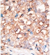 AP11345PU-N - APOBEC3B