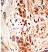 AP11346PU-N - APOBEC3A