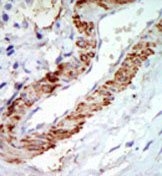 AP14782PU-N - MAP3K8 / TPL-2