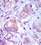 AP14791PU-N - MAP3K9