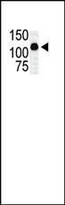 AP14793PU-N - MAP3K10