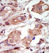 AP14793PU-N - MAP3K10