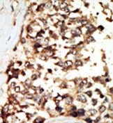AP14814PU-N - PRKD2 / PKD2