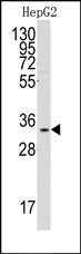 AP14673PU-N - C1QBP