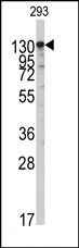 AP14675PU-N - Isoleucyl-tRNA synthetase / IARS2