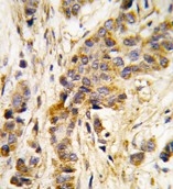 AP14675PU-N - Isoleucyl-tRNA synthetase / IARS2