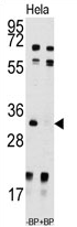 AP13860PU-N - UCK2