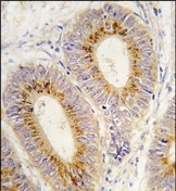 AP14677PU-N - MARS2