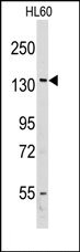 AP14680PU-N - VARS (Valyl-tRNA synthetase)