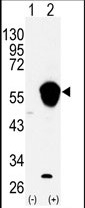 AP14686PU-N - ALDH3
