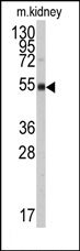 AP14688PU-N - ALDH9A1 / ALDH9