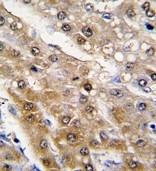 AP14688PU-N - ALDH9A1 / ALDH9