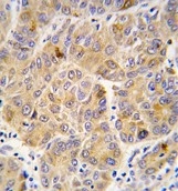 AP14689PU-N - ALDH9A1 / ALDH9
