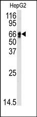 AP14695PU-N - Angiotensinogen