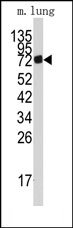 AP14716PU-N - AMP deaminase 3 / AMPD3