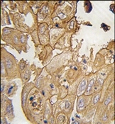 AP14718PU-N - Glia maturation factor gamma / GMFG
