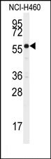 AP14730PU-N - CYP21A2