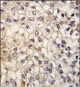 AP14733PU-N - CYP2F1