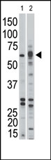 AP14598PU-N - Activin receptor type 1B / ACVR1B